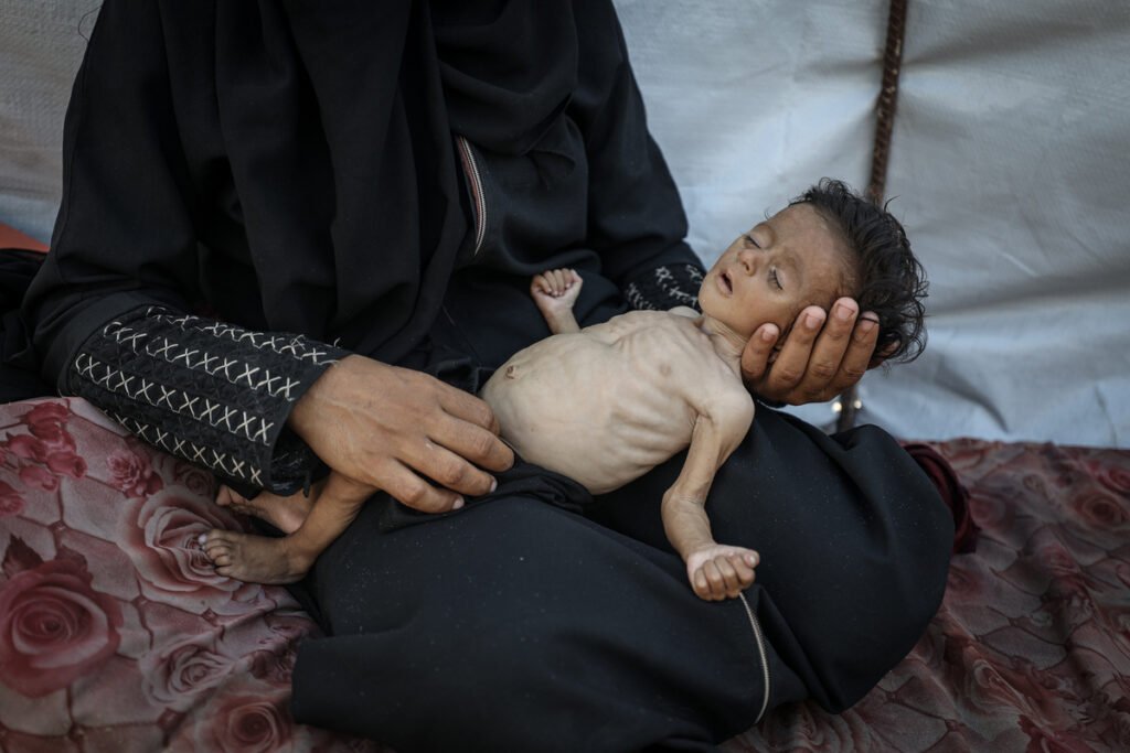 Palestinian doctors warn starving Gaza children could die ‘not in weeks but days’